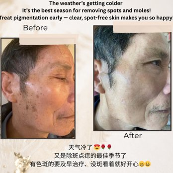 Pigmentation care