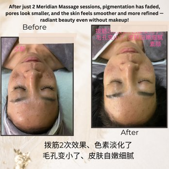 Meridian massage 拨筋